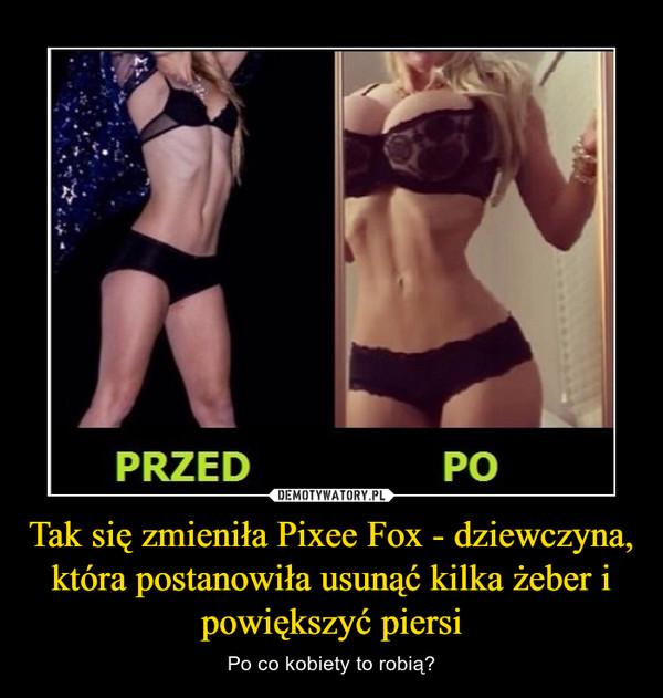 Tak się zmieniła Pixee Fox - dziewczyna, która postanowiła usunąć kilka żeber i powiększyć piersi – Po co kobiety to robią? 