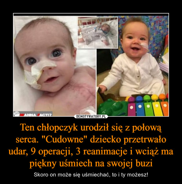 Ten chłopczyk urodził się z połową serca. "Cudowne" dziecko przetrwało udar, 9 operacji, 3 reanimacje i wciąż ma piękny uśmiech na swojej buzi – Skoro on może się uśmiechać, to i ty możesz! 